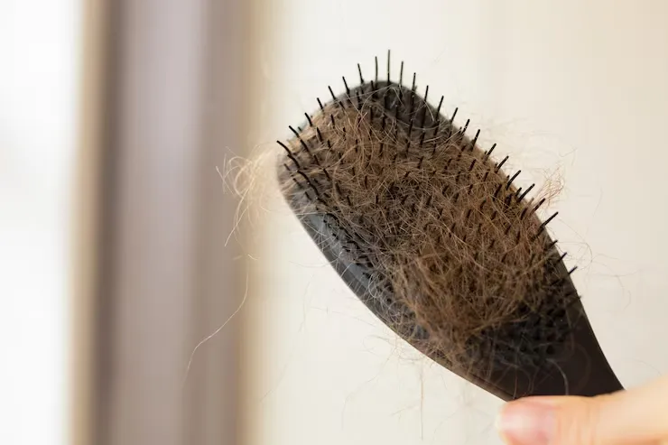 Homeopathic Medicine for Hair Loss Causes Remedies and Treatment Options