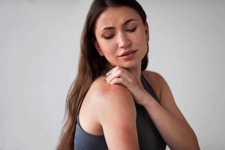 Shingles Meaning: Herpes Zoster Causes, Stages