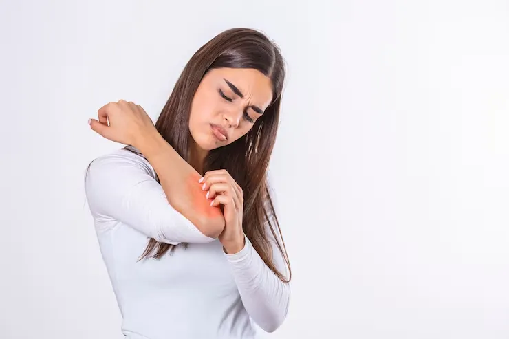 Treatment of Itching in Whole Body Safe Next Steps Based on the Cause
