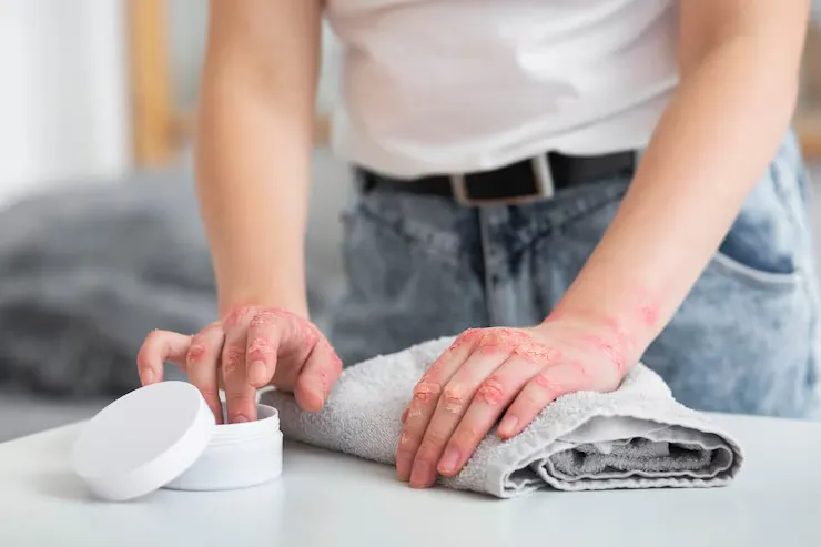 Burning and Itchy Skin: Back Itching Causes and When to See a Doctor