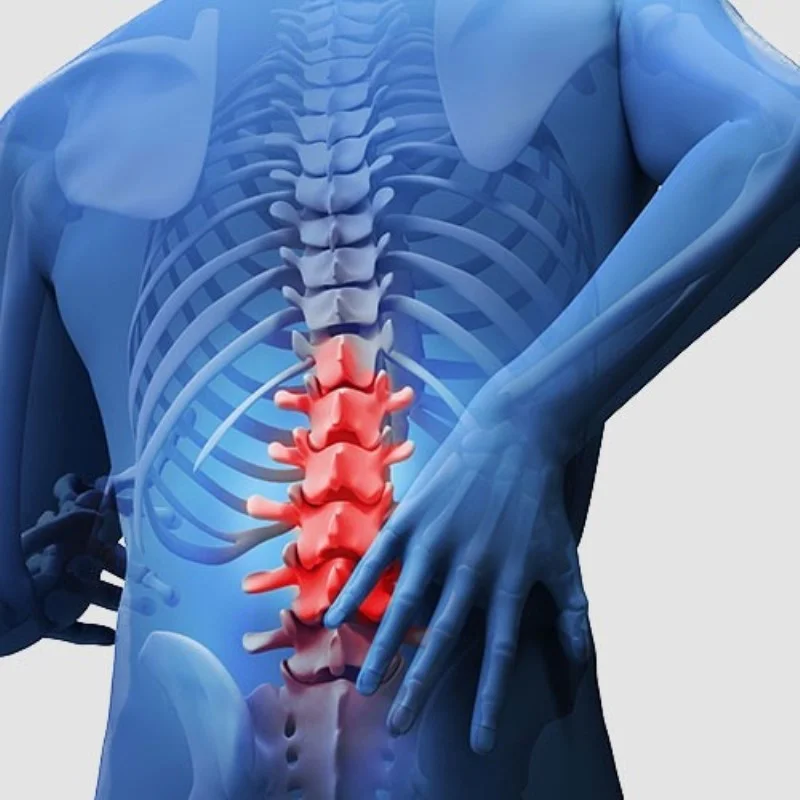 Lumbar
                    Spondylosis
                    