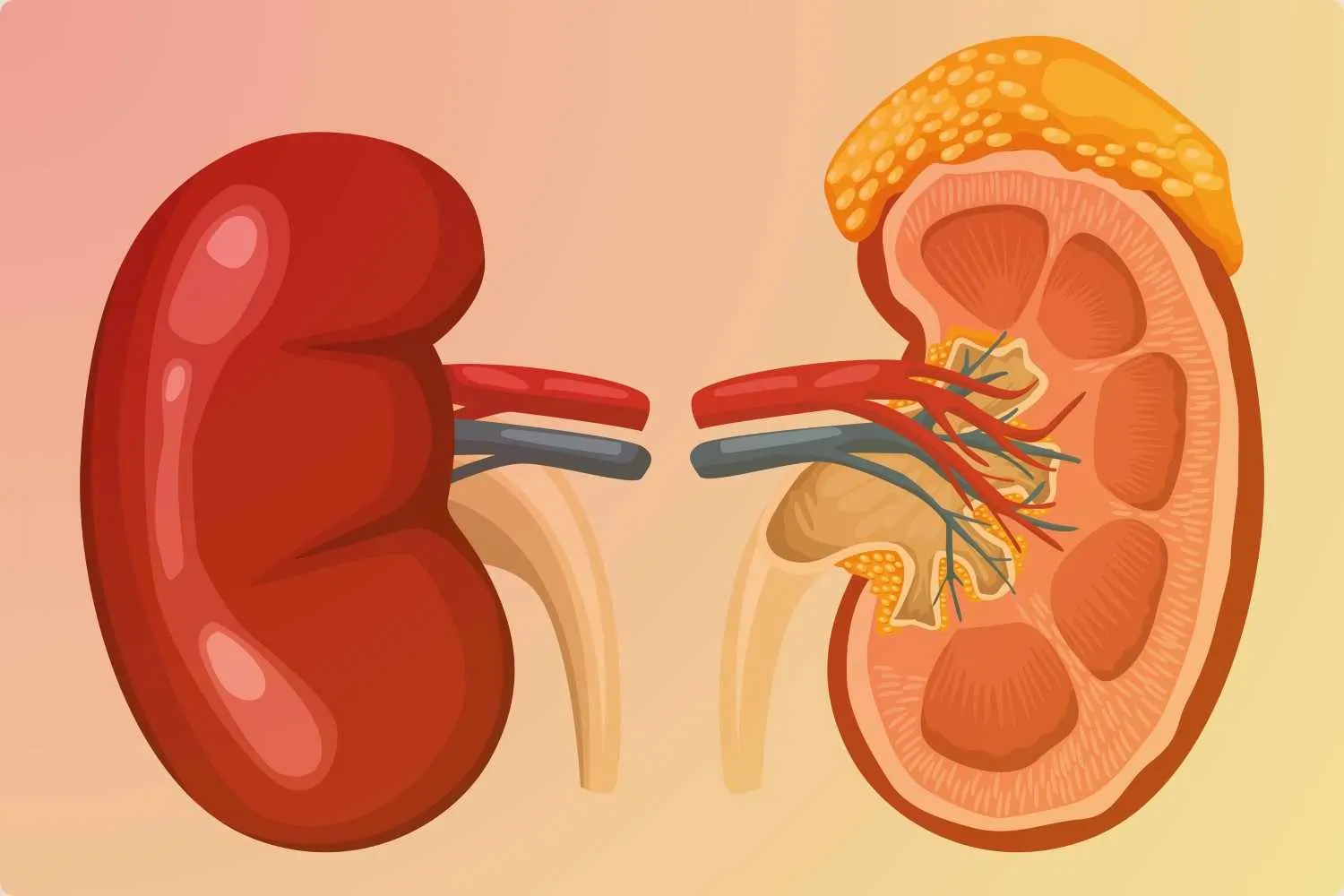 Nephrotic
                    Syndrome
                    