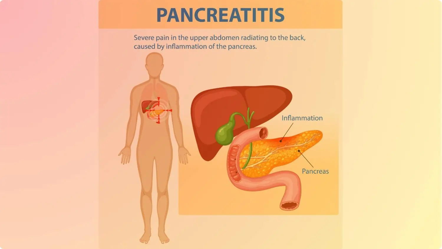 Pancreatitis