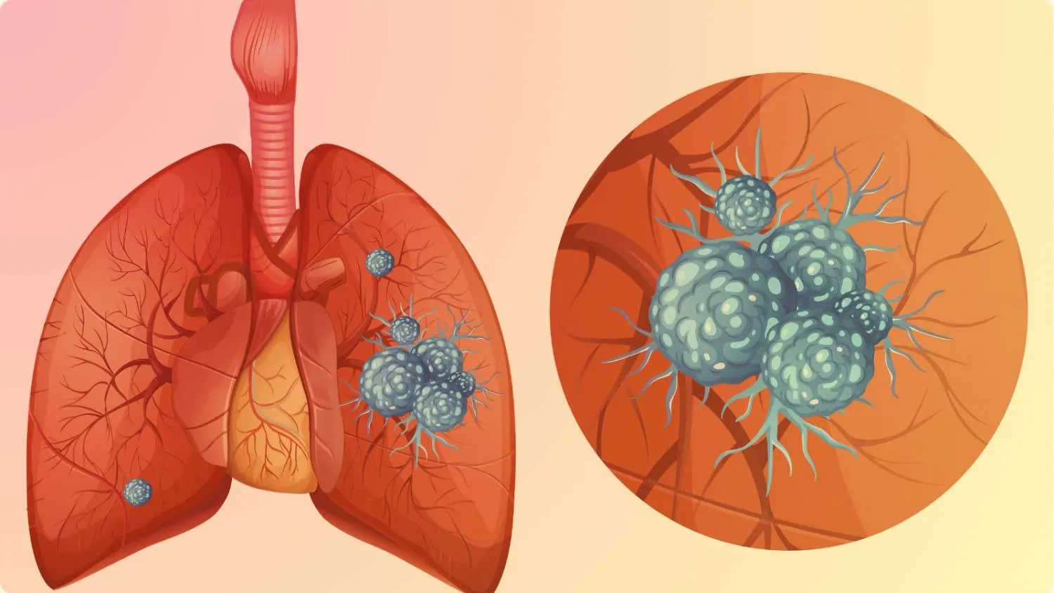 Respiratory
                    Disorders
                    