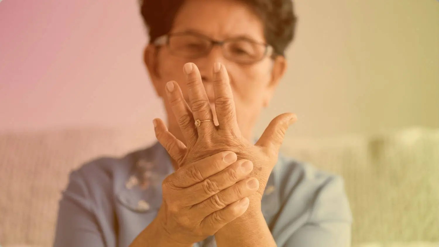 Rheumatoid Arthritis