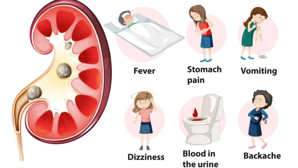 Symptoms of Hypothyroidism
