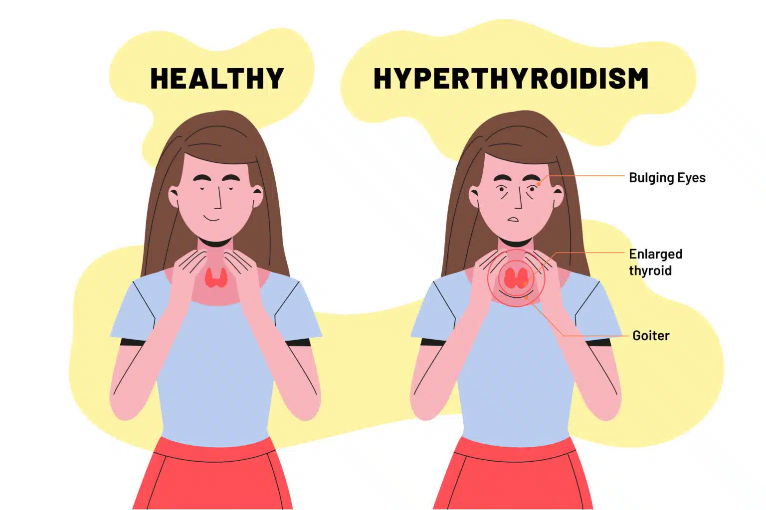 Symptoms of Hypothyroidism