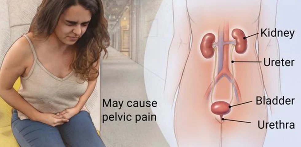 Urinary Tract
                    Infection
                    