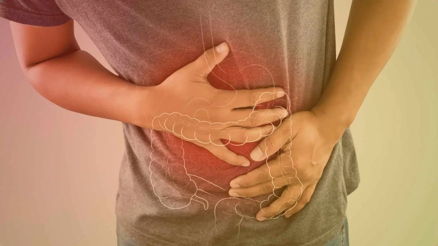 Inflammatory Bowel Disease(IBD)