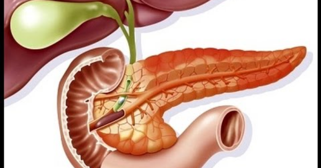 Pancreatitis