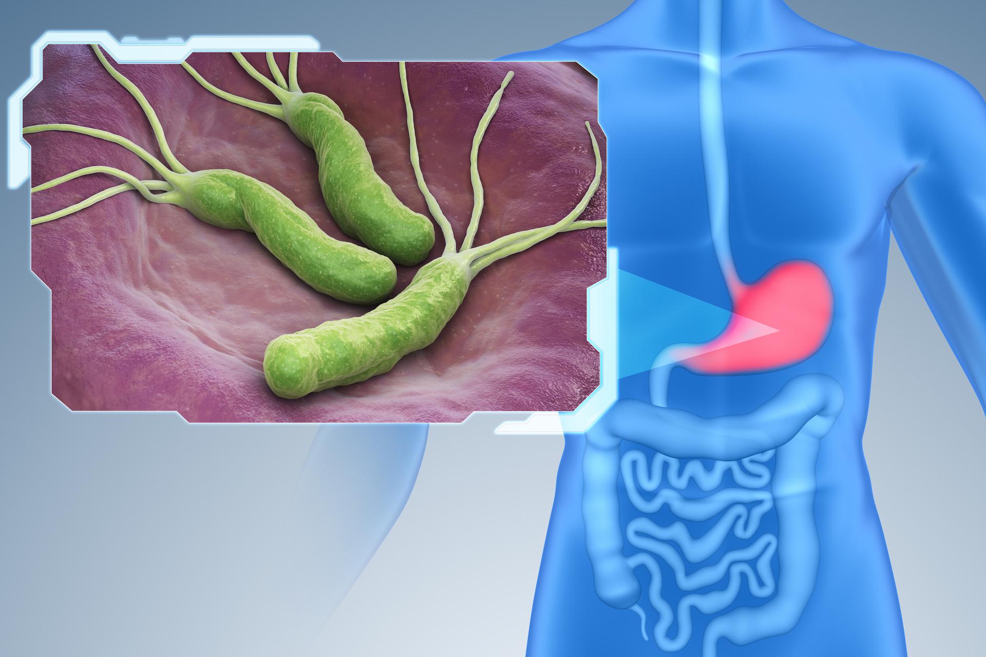 H Pylori Dr.Tathed s Homeopathy