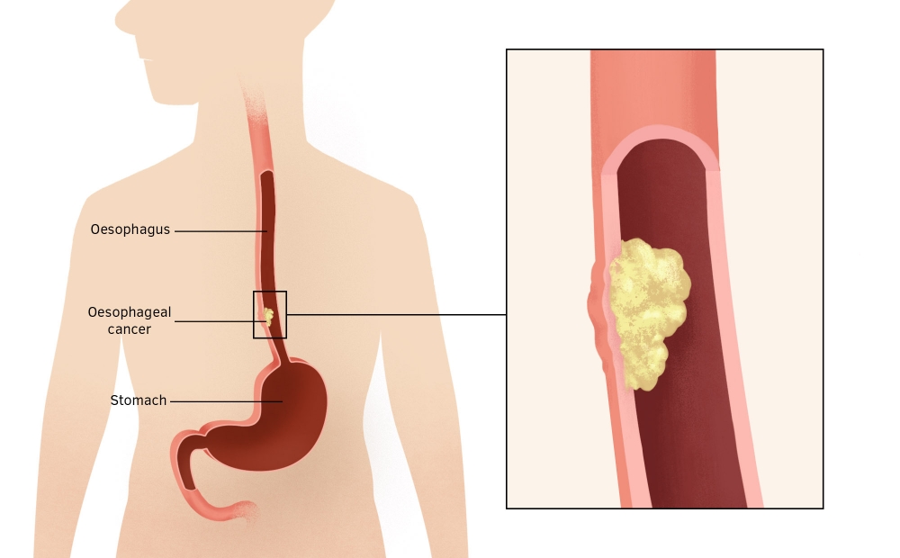 oesophagus