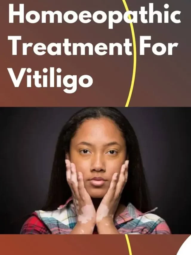 cropped-Homeopathy-treatment-for-Vitiligo.webp