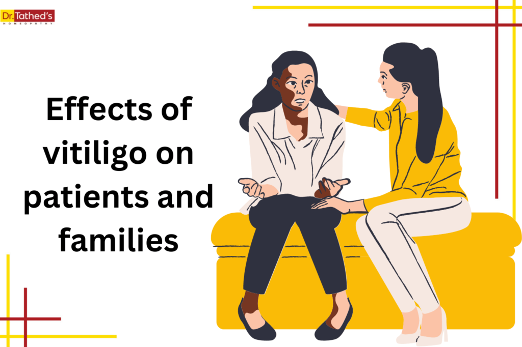 What are the effects of vitiligo on patients and families