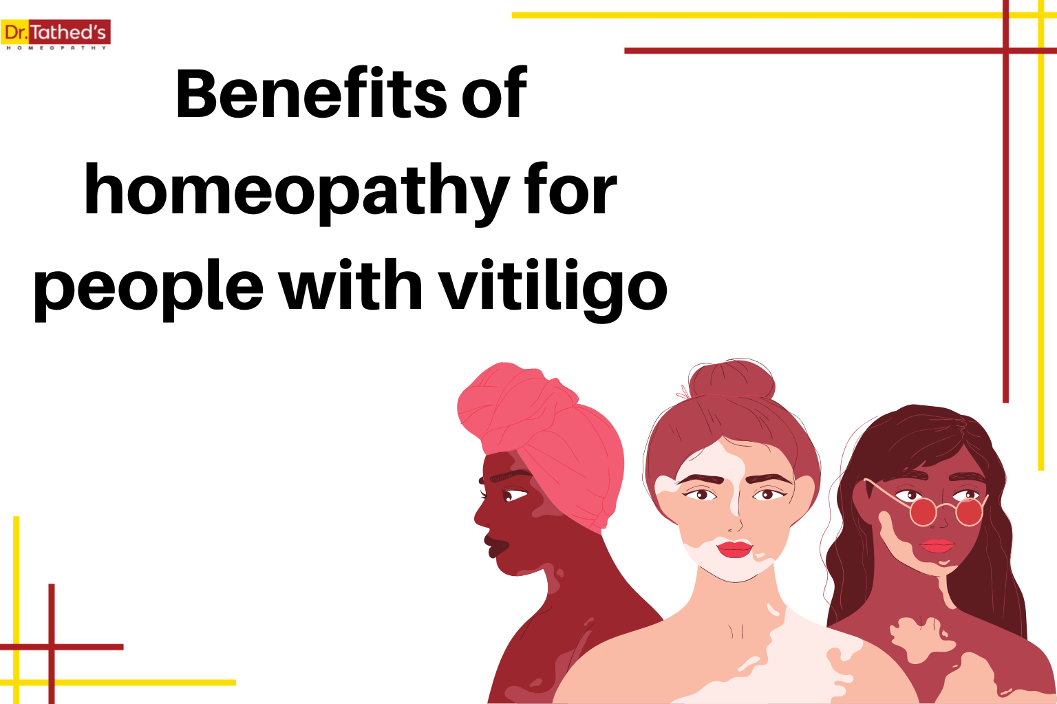 Benefits of homeopathy for people with vitiligo