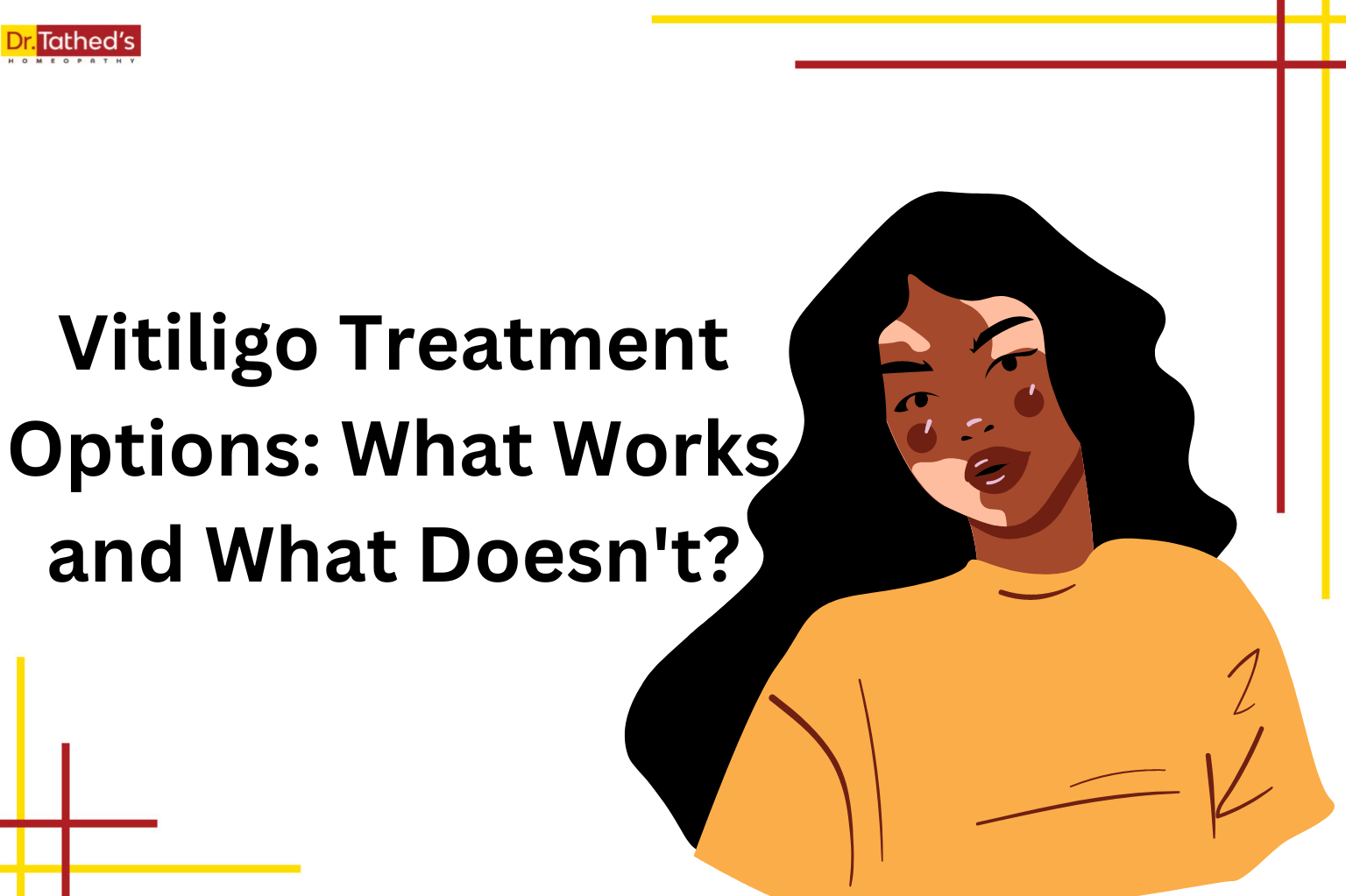 Vitiligo Treatment Options: What Works and What Doesn't?