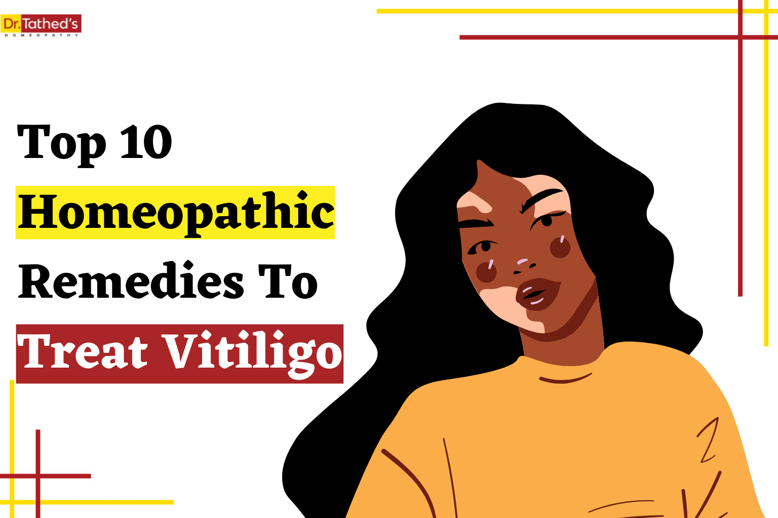 Top 10 Homeopathic Remedies To Treat Vitiligo