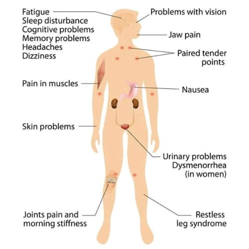 Homeopathic Treatment for Fibromyalgia - Dr.Tathed's Homeopathy