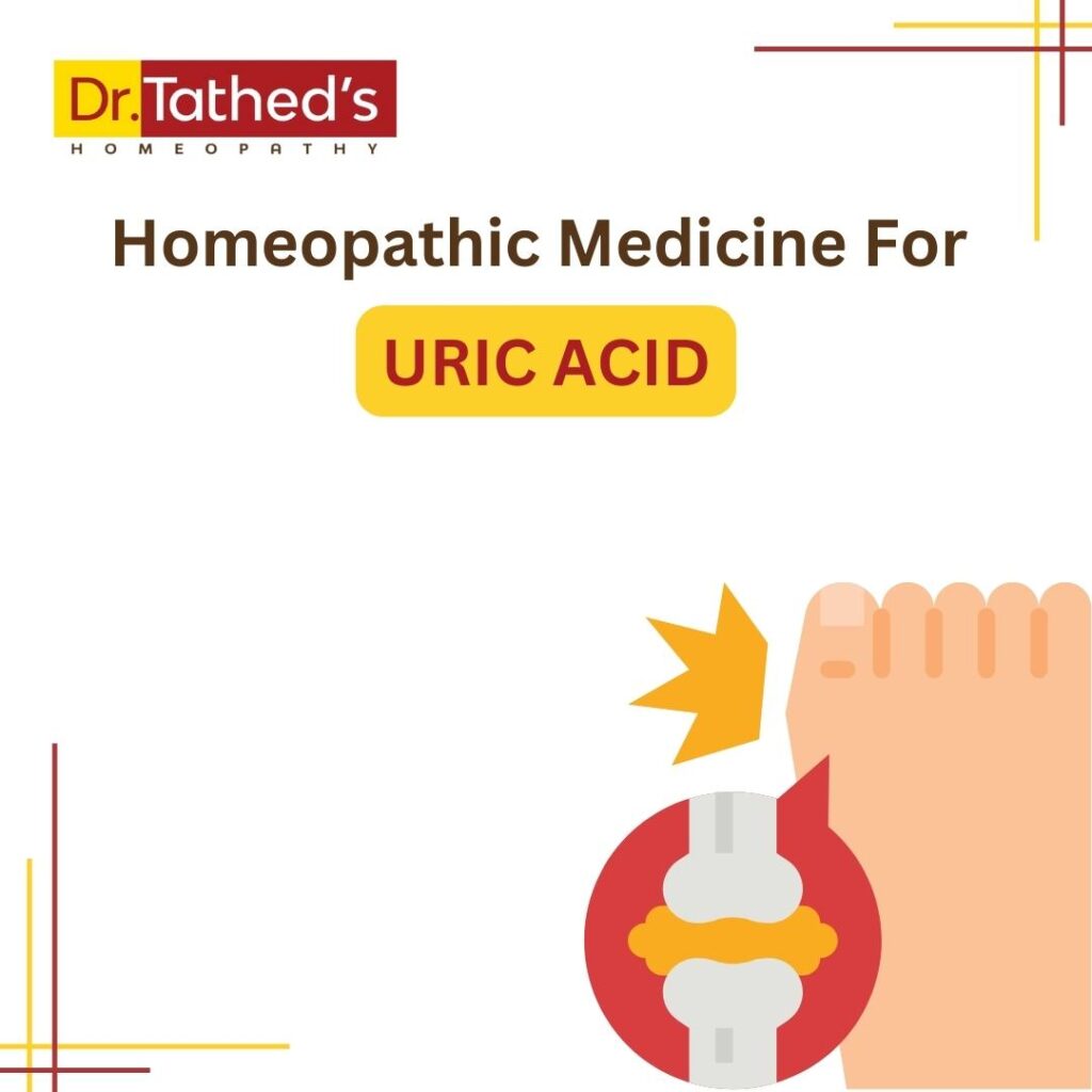 Homeopathic Medicine for Uric Acid