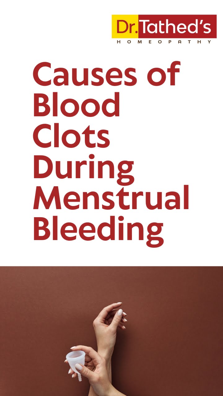 5 Shocking Causes of Blood Clots During Menstrual Bleeding and How  Homeopathic Remedies Can Help - Dr.Tathed's Homeopathy