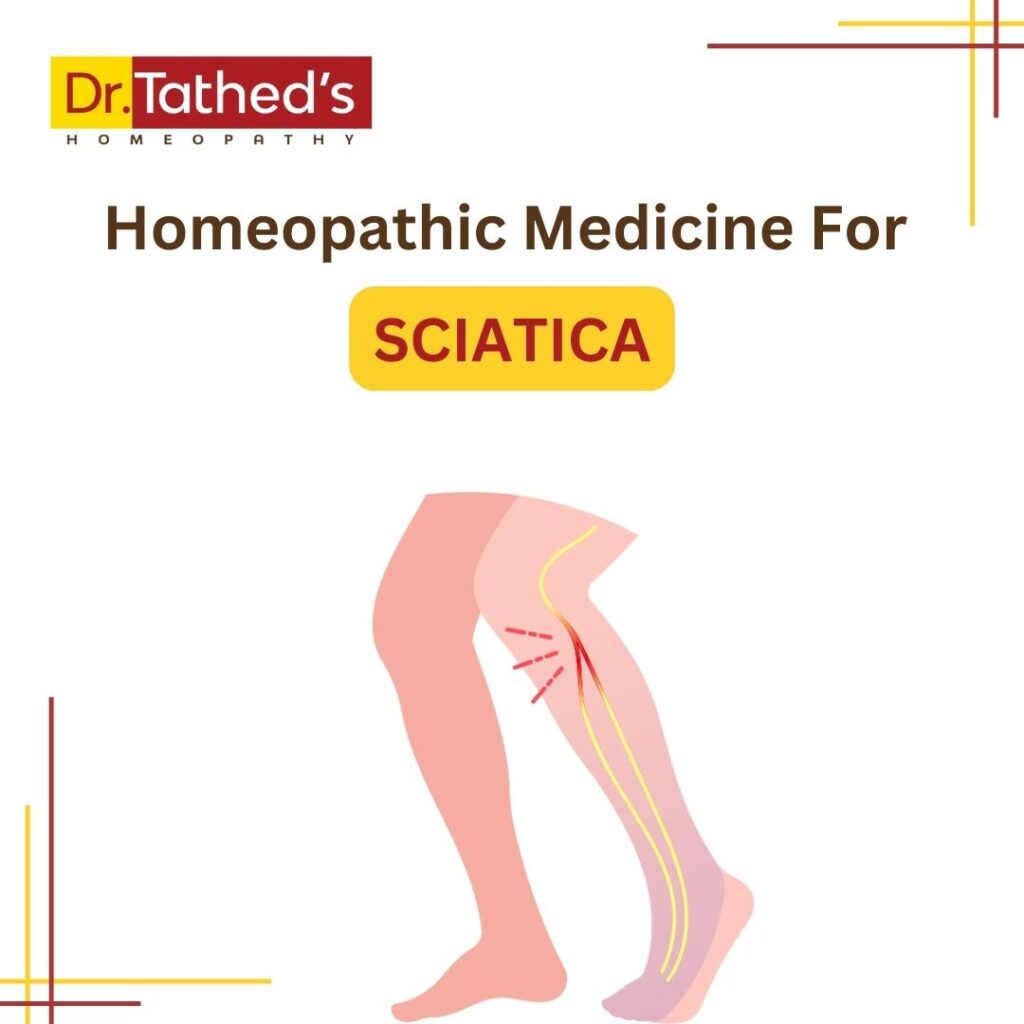 Homeopathy Medicine For Sciatica