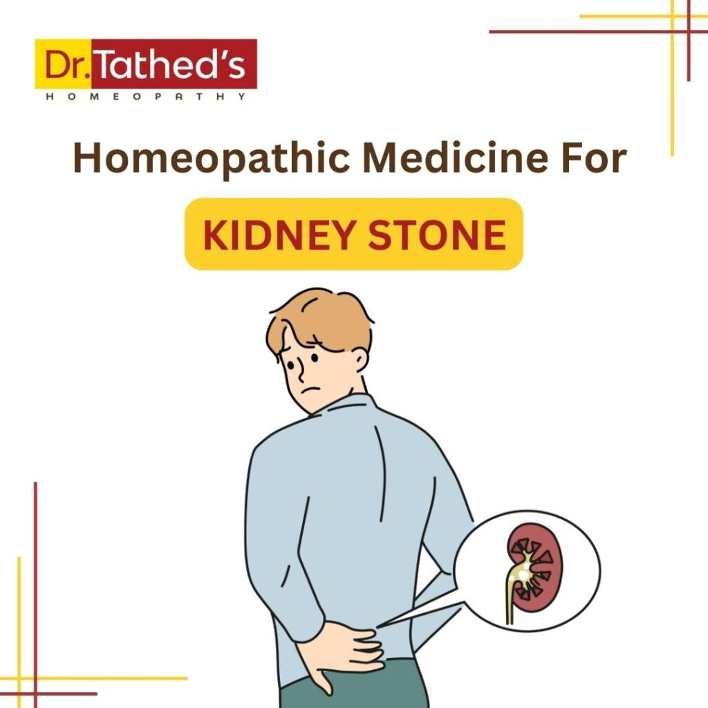 Homeopathic Medicine for Kidney Stone: A Natural Approach to Healing