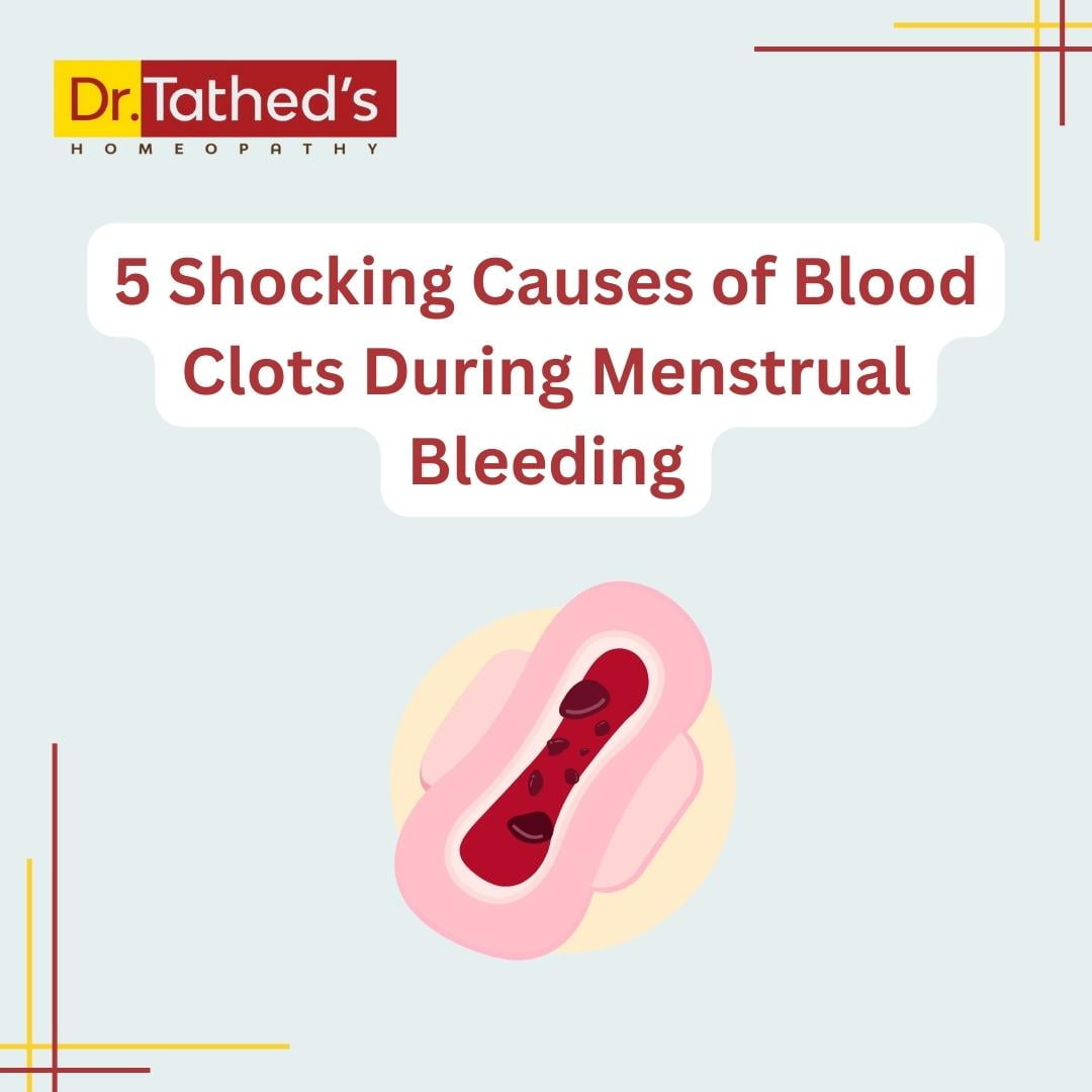 5 Shocking Causes of Blood Clots During Menstrual Bleeding and How  Homeopathic Remedies Can Help - Dr.Tathed's Homeopathy