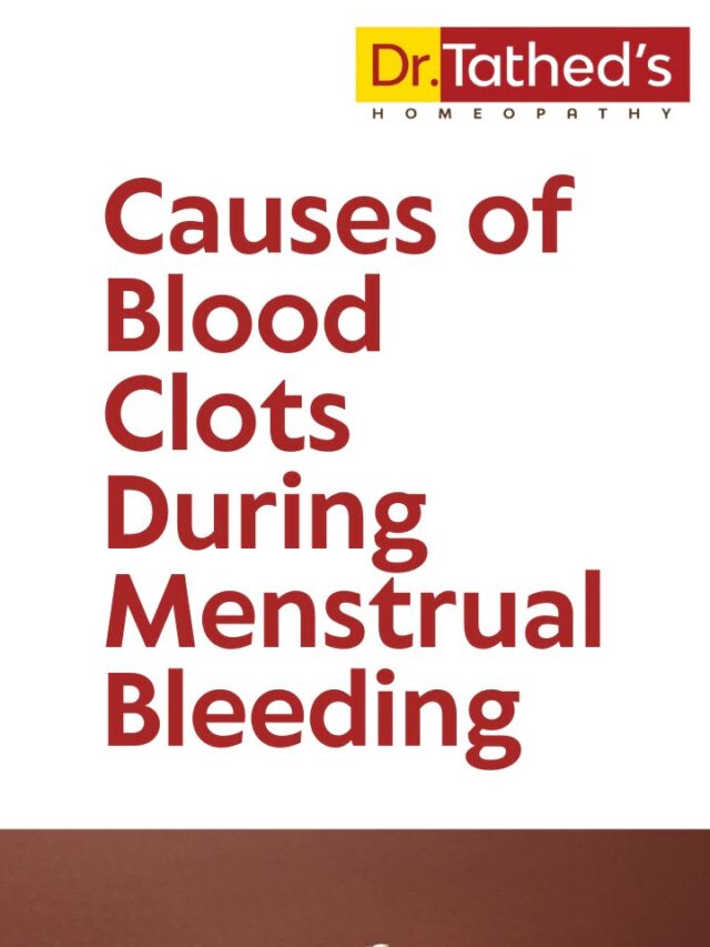 Causes of Blood Clots During Menstrual Bleeding