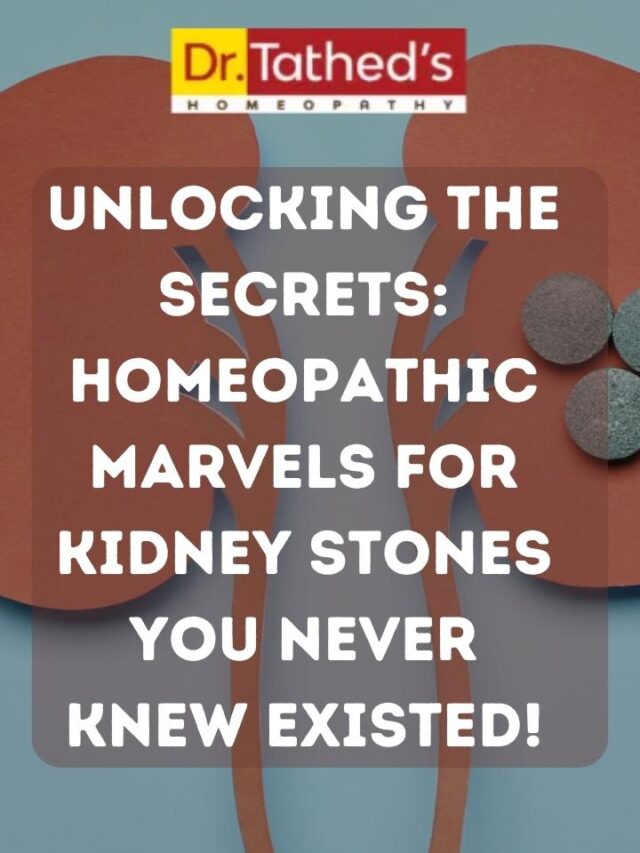 Unlocking the Secrets: Homeopathic Marvels for Kidney Stones You Never Knew Existed!