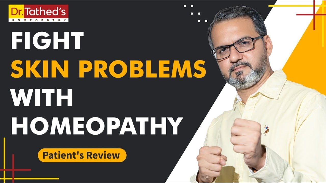OVARIAN CYST - Dr.Tathed's Homeopathy