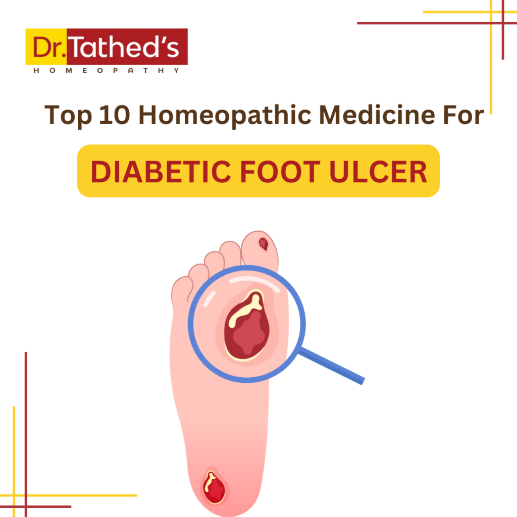 Top 10 homeopathic medicines for diabetic foot ulcer