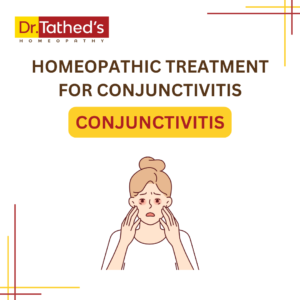 Homeopathy Treatment for Conjunctivitis