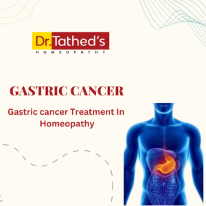 Understanding Gastric Cancer: Symptoms, Risk Factors, and Treatment Options