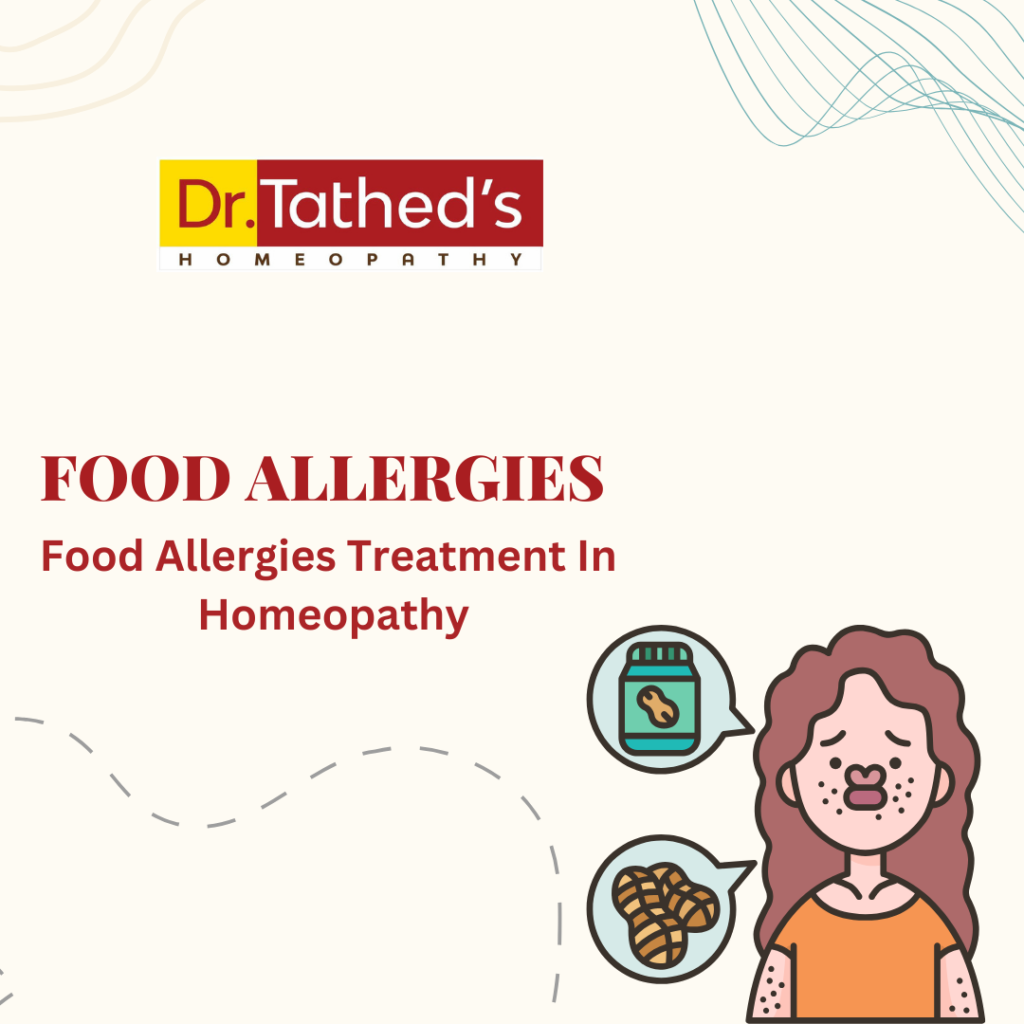 Food Allergies : and Homeopathy: A Natural Approach to Relief