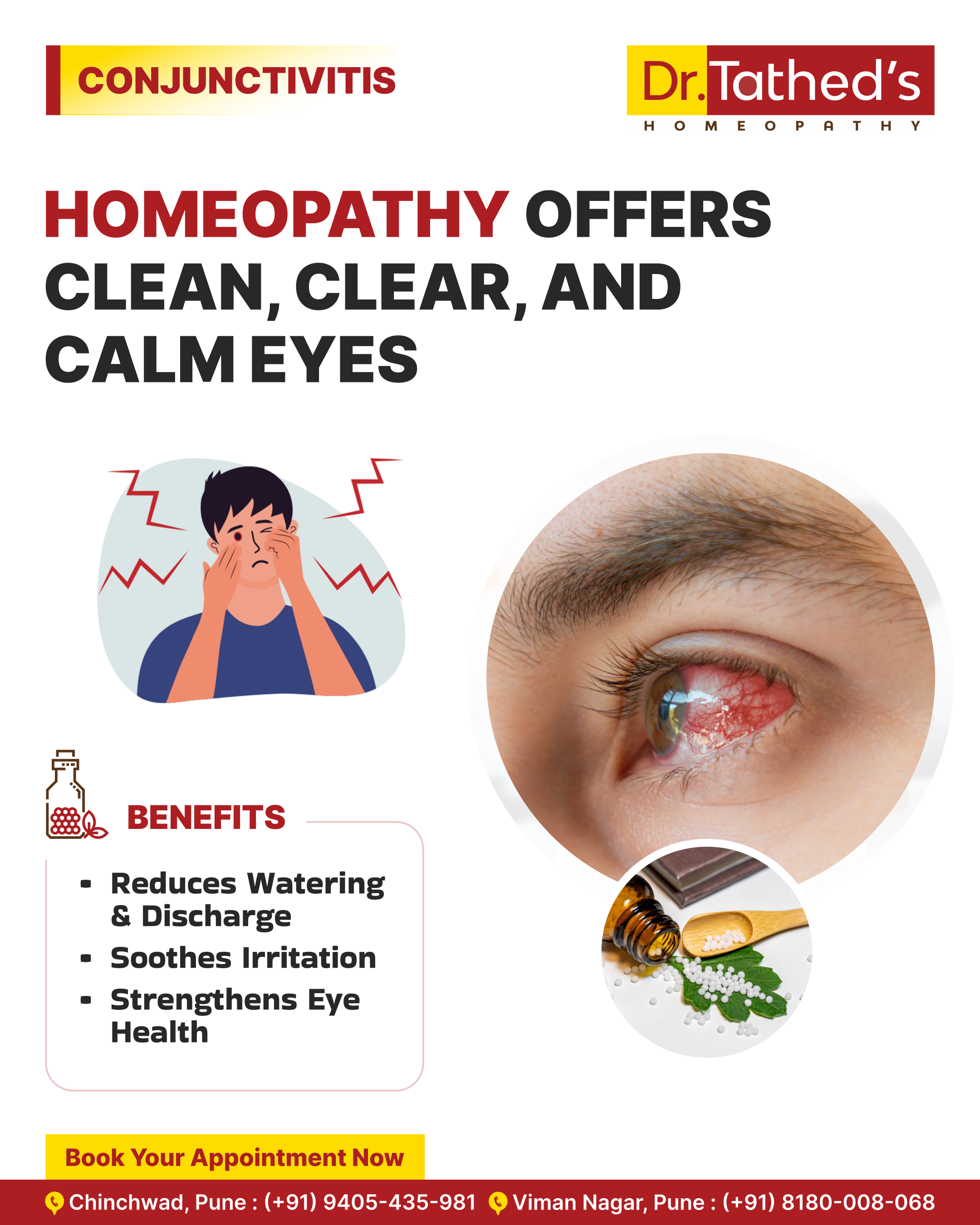 Blogs 3 Homeopathy for Conjunctivitis: Safe and Effective Natural Eye Treatments