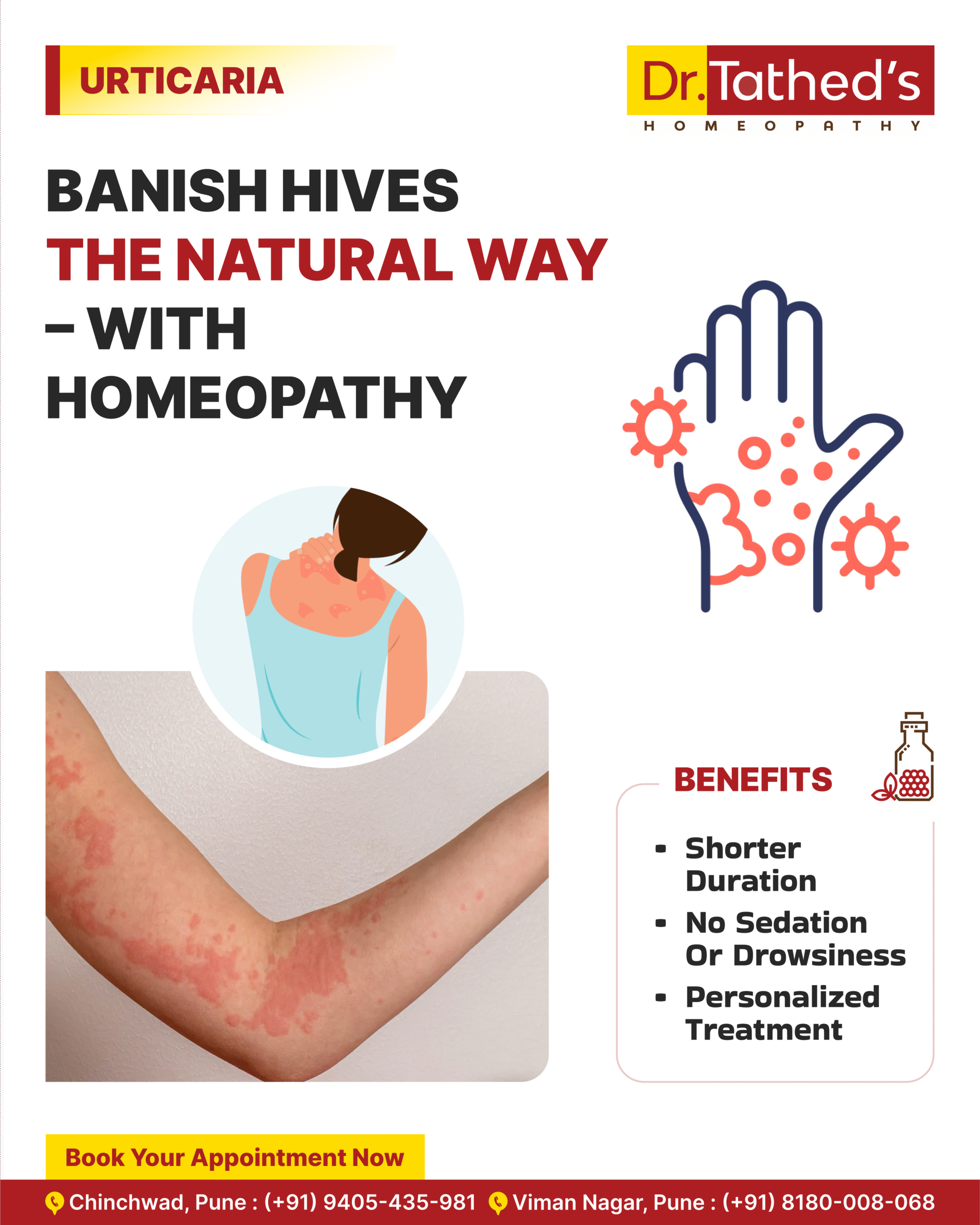 Homeopathy Doctor in Viman Nagar 10 Urticaria Relief the Natural Way: 6 Homeopathic Remedies You Can Trust