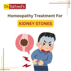 Homeopathy Treatment for Kidney Stones