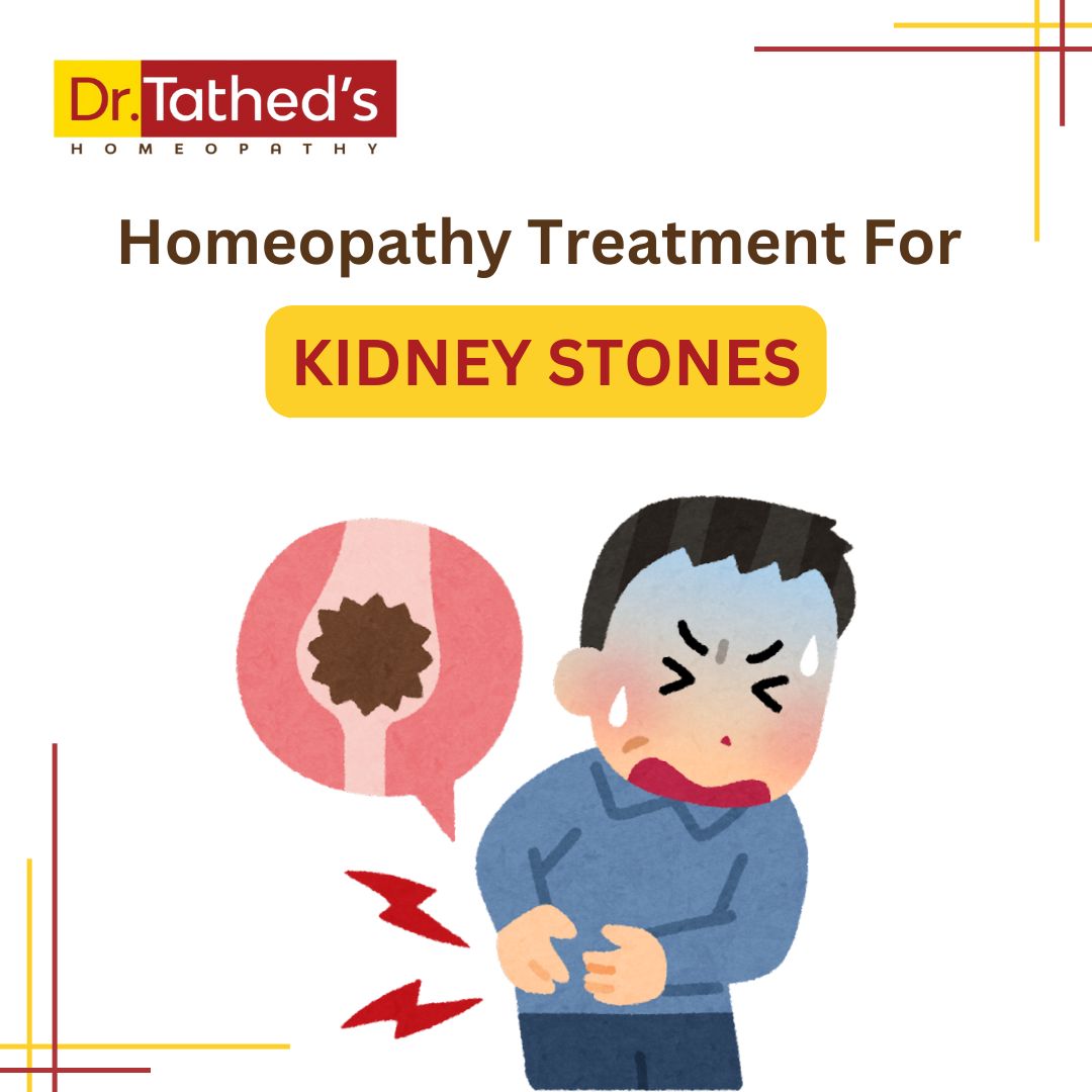 Homeopathy Treatment for Kidney Stones
